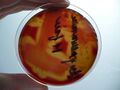 S. pneumoniae na krevním agaru, M-fáze, detail hemolýzy
